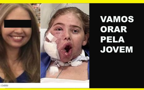 Jéssica Carvalho luta corajosamente contra um câncer foto via G1