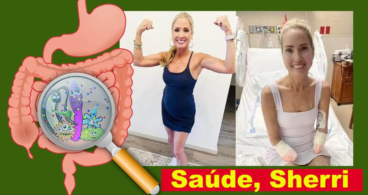 Mulher tem mãos e pés amputados após sentir dor de garganta Sherri Moody fotos arquivo pessoas e pixabay