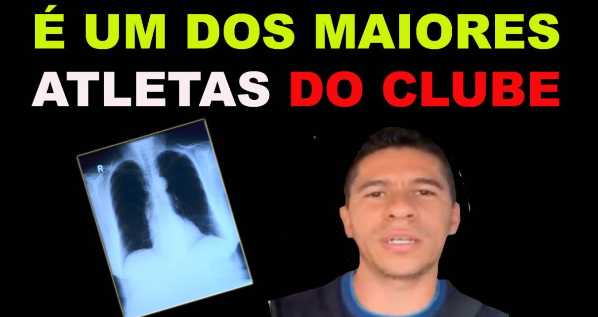Osvaldo, do Vitória, recebe alta após ficar dois dias internado por tromboembolismo pulmonar