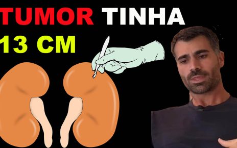 TUMOR - Rodrigão veio à público nesta quinta-feira (19) explicar que, por conta do tumor que enfrentou, precisou remover seu rim esquerdo e o baço. “Tive uma hemorragia e fui internado às pressas, onde foi detectado um tumor de 13 centímetros”, narrou. “O médico falava que era uma bola de handebol. Tinha um tumor de 13 centímetros dentro de mim, estava em volta do meu rim, já estava batendo no meu baço”, explicou ele.