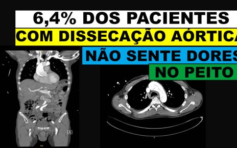 Homem em forma sofre ruptura arterial horrível desencadeando emergência cardíaca fatal após se masturbar