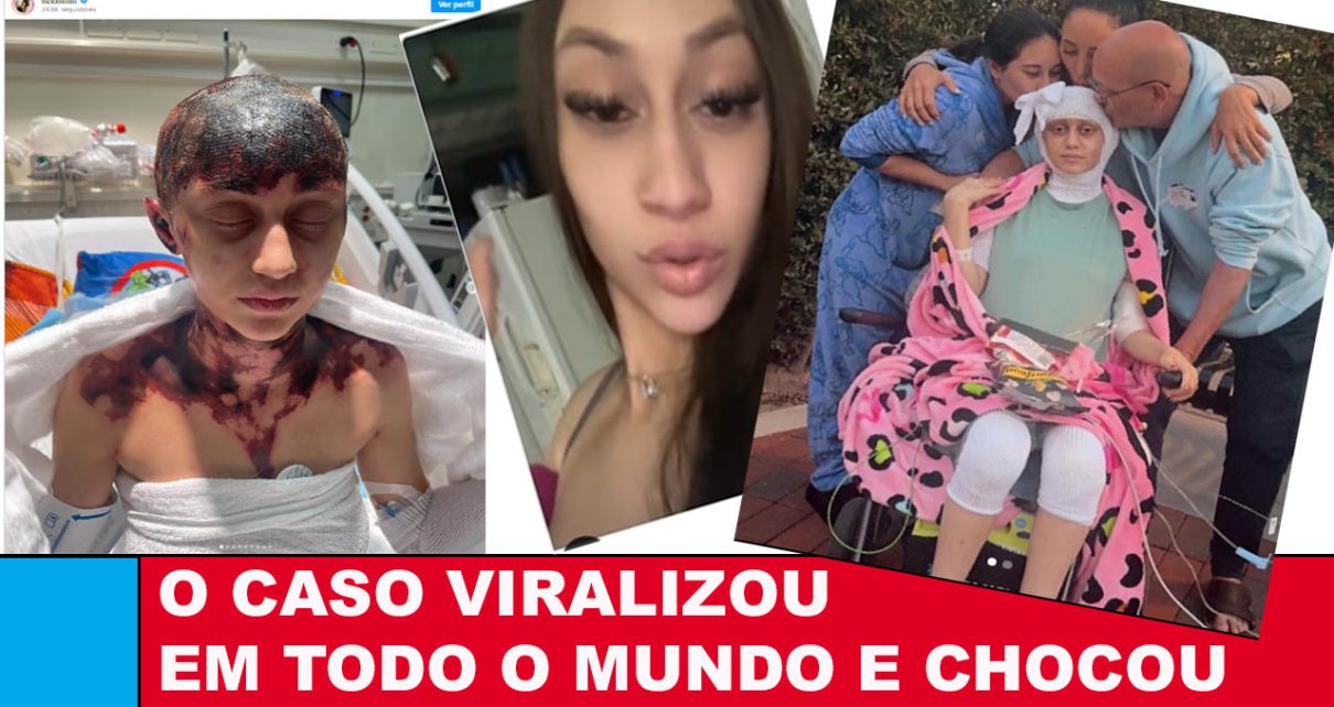 Mulher se recupera de ferimentos HORRÍVEIS após receber três vacinas de uma vez - CENAS FORTES - VÍDEO