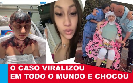 Mulher se recupera de ferimentos HORRÍVEIS após receber três vacinas de uma vez - CENAS FORTES - VÍDEO