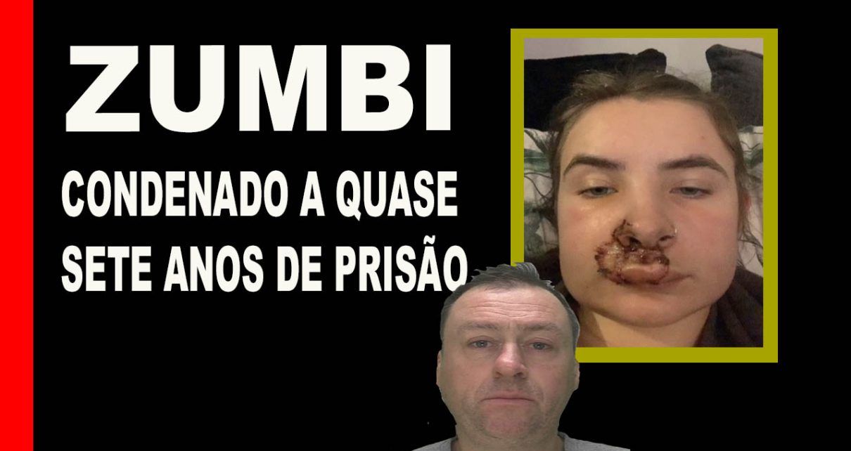 Estudante de 19 anos revela ferimentos chocantes após ataque aleatório de estranho em um ônibus