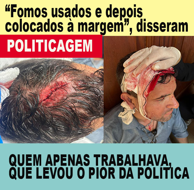 CONFUSÃO LULA - Tumulto em visita dele ao ES termina com segurança agredido por indígena; "Fomos usados para divulgar o evento, para dar visibilidade", DISSE UMA LIDERANÇA - SE NÃO FOSSEM INDÍGENAS, HOJE NA MÍDIA, "SERIA ATENTADO" - FOTOS