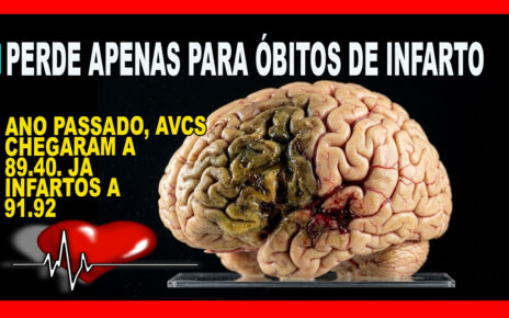 CAMPEÃO - Brasil é o país mais afetados por AVC no mundo FOTOS IA GEMINI e pixabay
